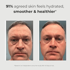 ABERA Sérum Rétinol — application sur le visage, confort et douceur.