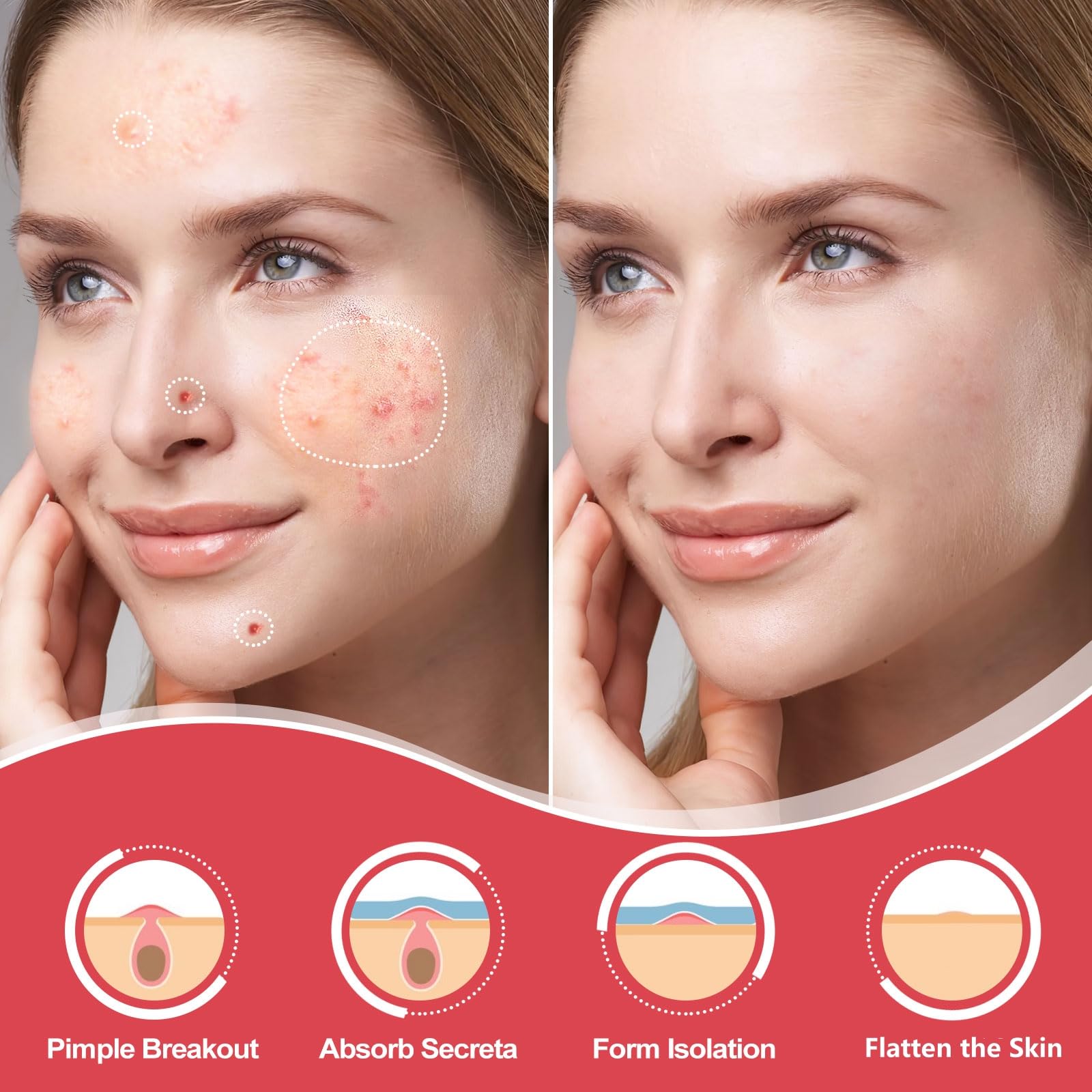 AcneGo patches adhèrent durablement au visage pendant la nuit.