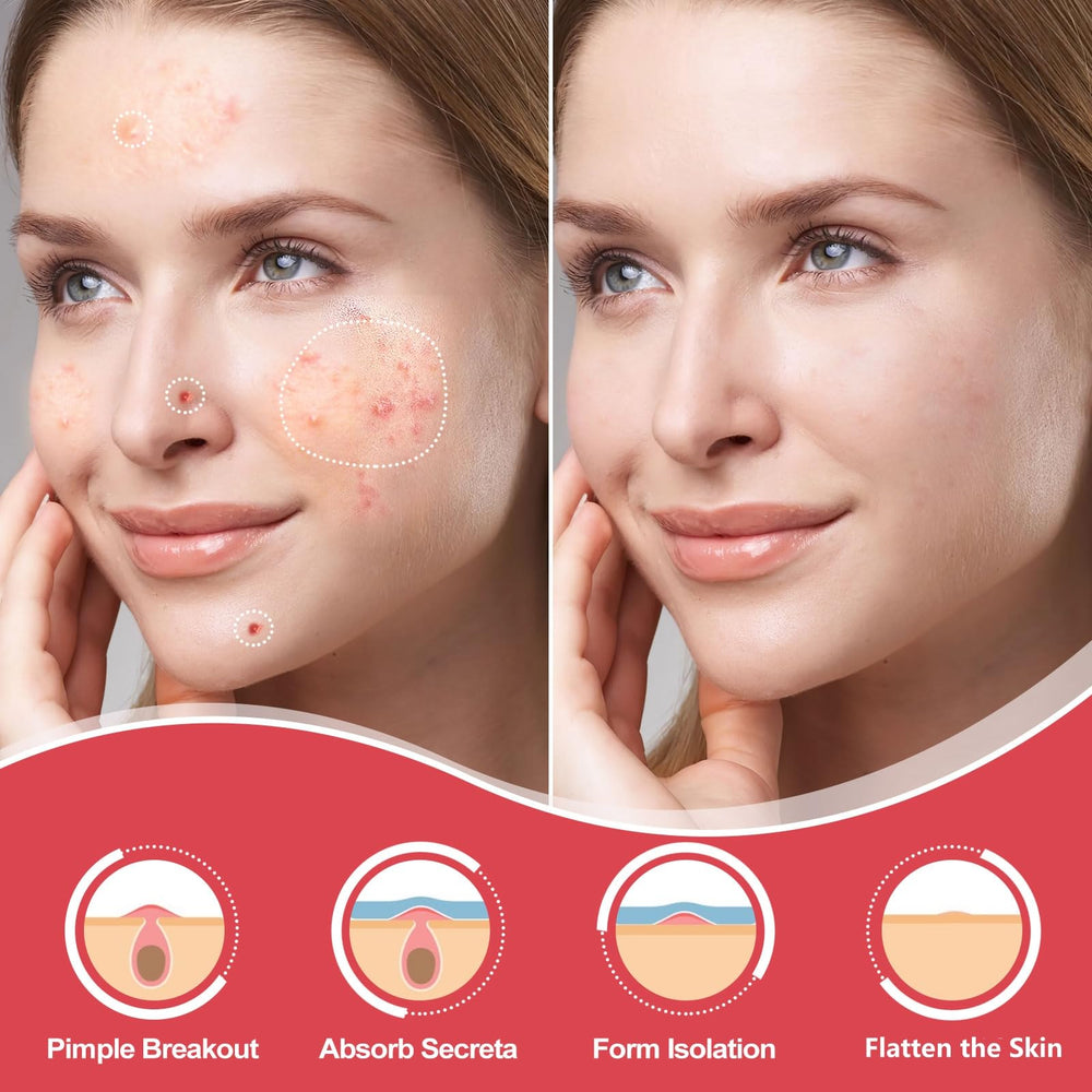 AcneGo patches adhèrent durablement au visage pendant la nuit.