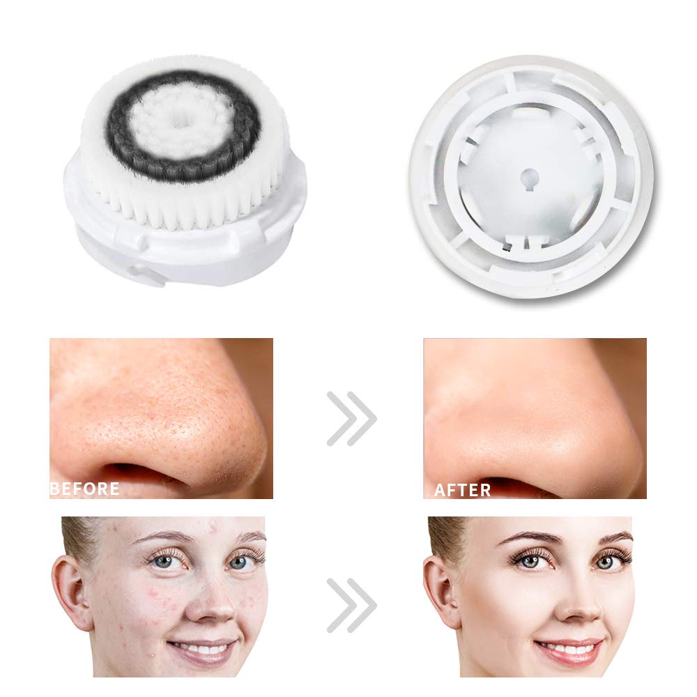 Acosexy pièces de haute qualité pour durabilité et performance