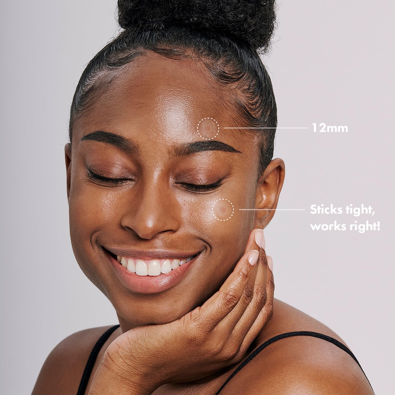 Patch Acropass niacinamide bouclier: soutient la peau pendant le soin.