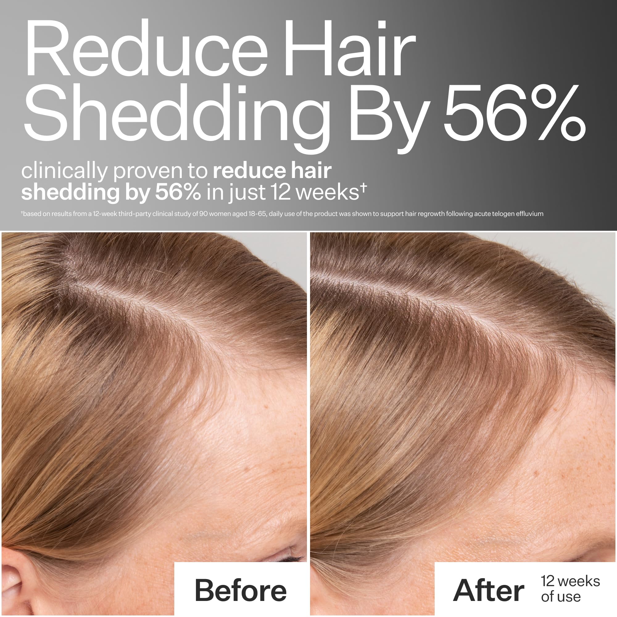 Act+Acre après-shampooing cellules souches démêle et protège la cuticule.