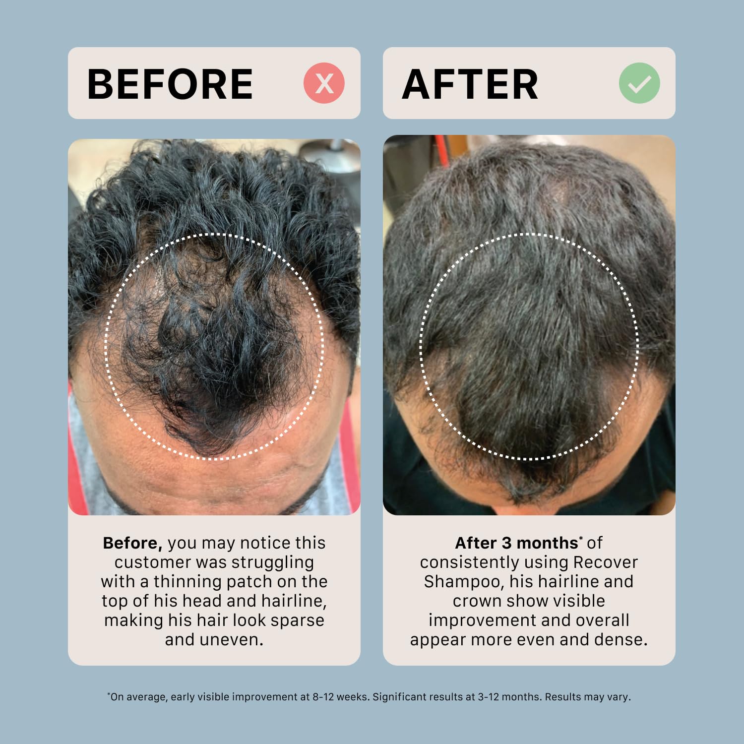 ACTIIV Recover Cheveux Plus Forts, résultats potentiels avec utilisation régulière