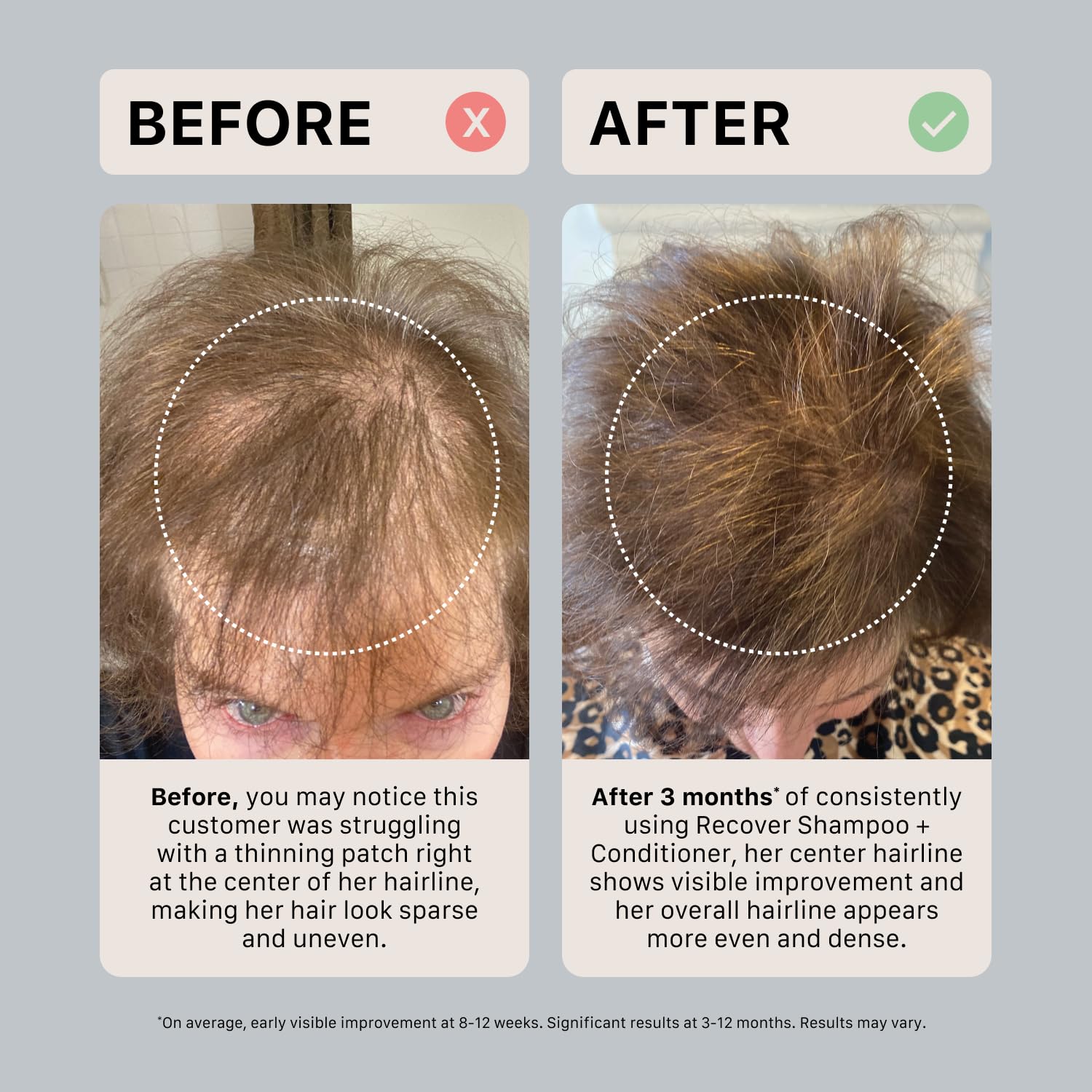 ACTIIV Recover: formule sans sulfates pour un lavage doux.