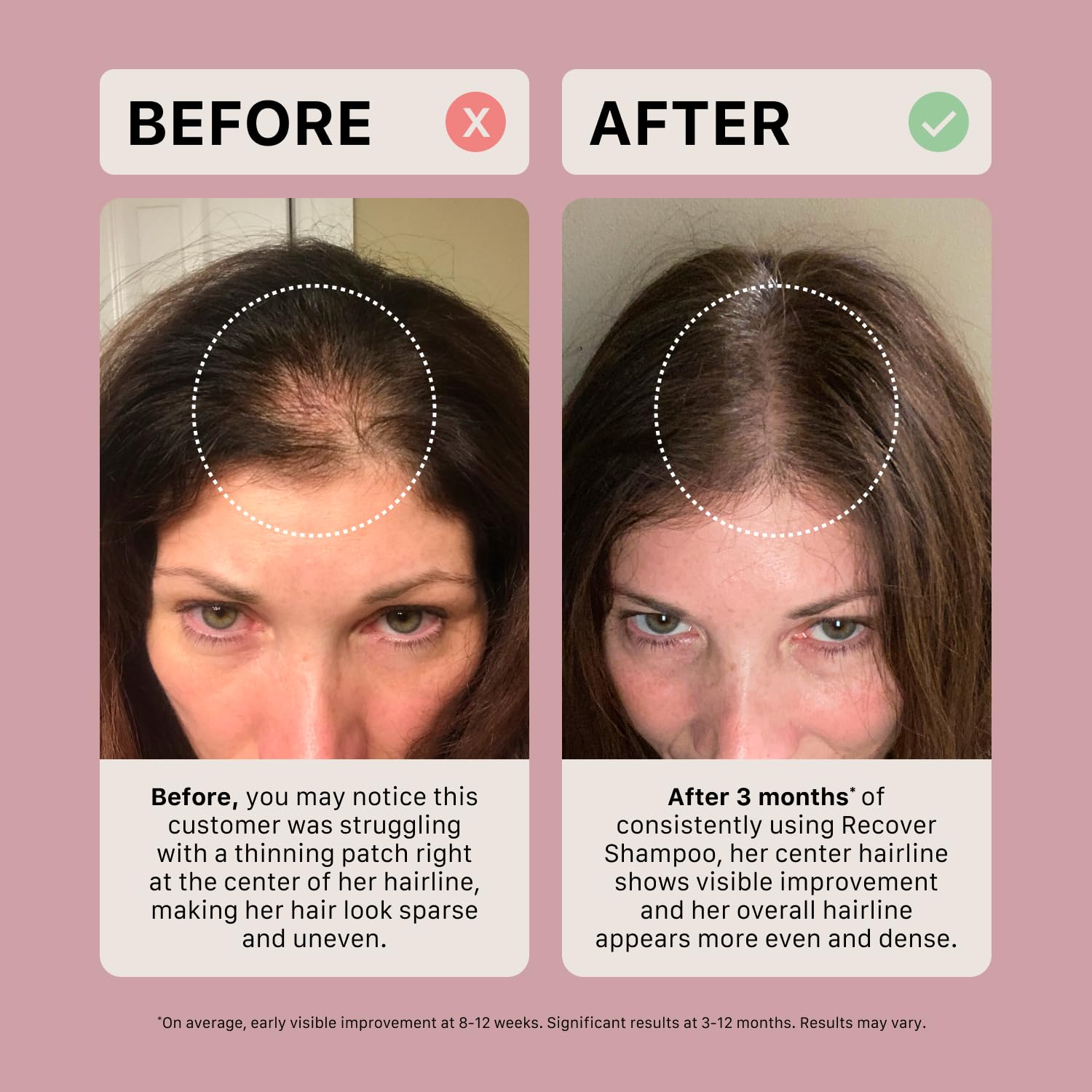 ACTIIV Recover Shampoo cheveux volumineux, apparence plus dense après chaque lavage.