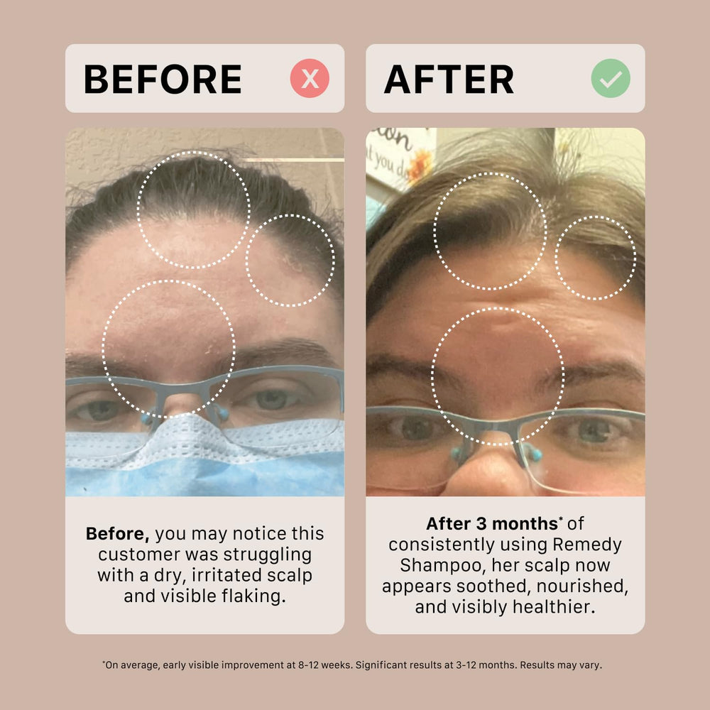 ACTIIV Remedy Shampoing — flacon végétal recyclable adapté à tous types.
