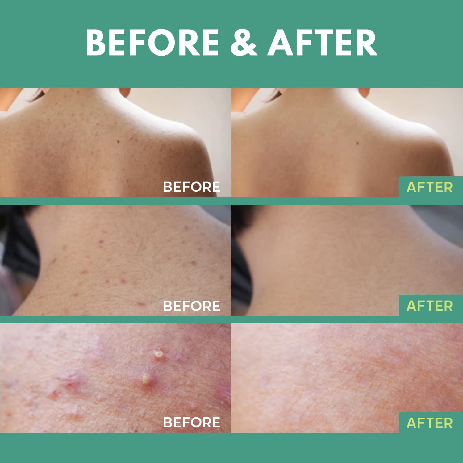 Test dermatologique assure une approche douce sur les imperfections.