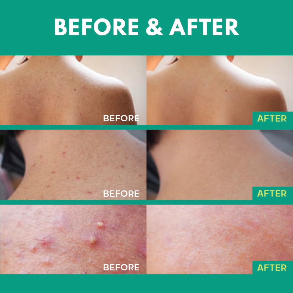 Test dermatologique assure une approche douce sur les imperfections.