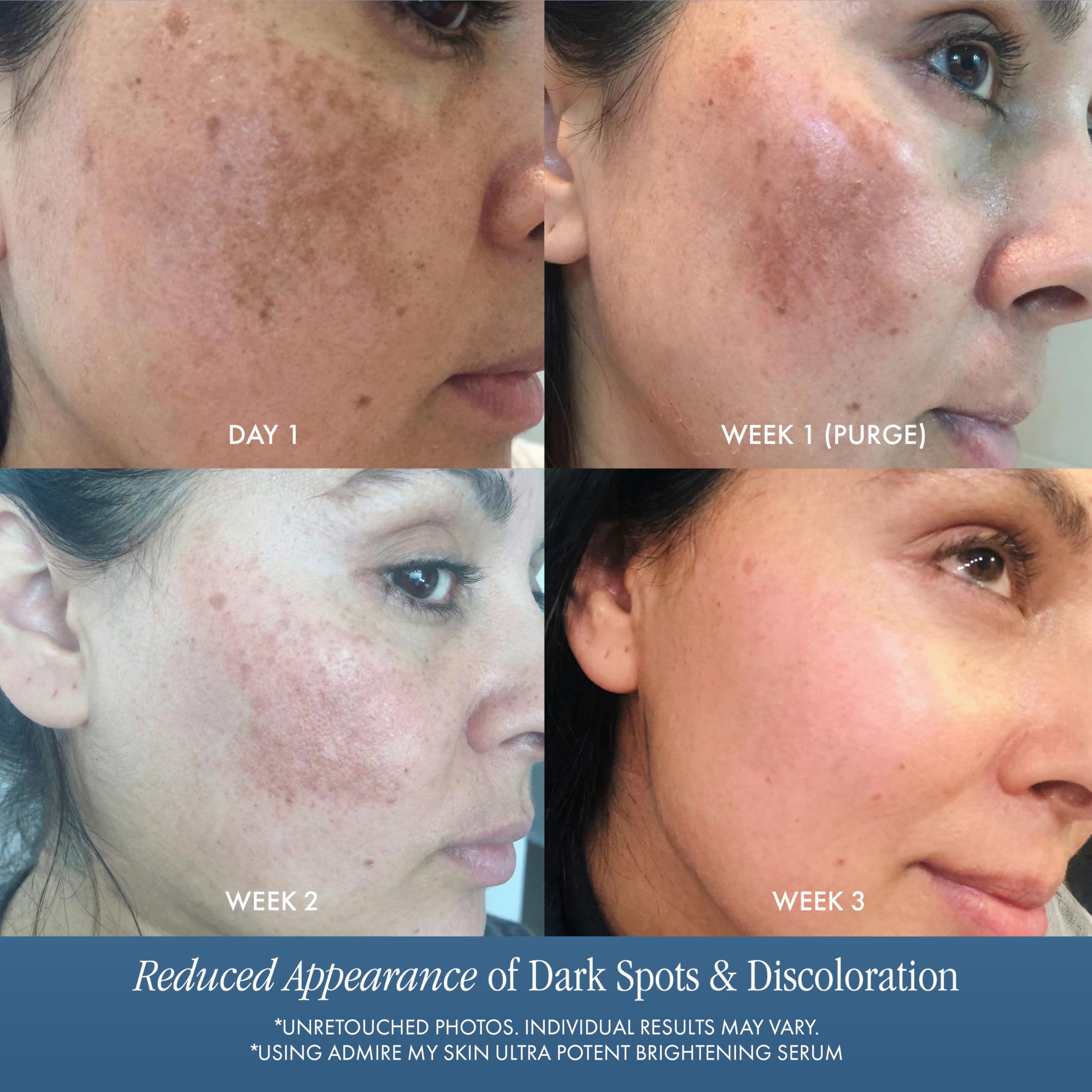Application quotidienne Admire My Skin, rituel visage simple et rapide.