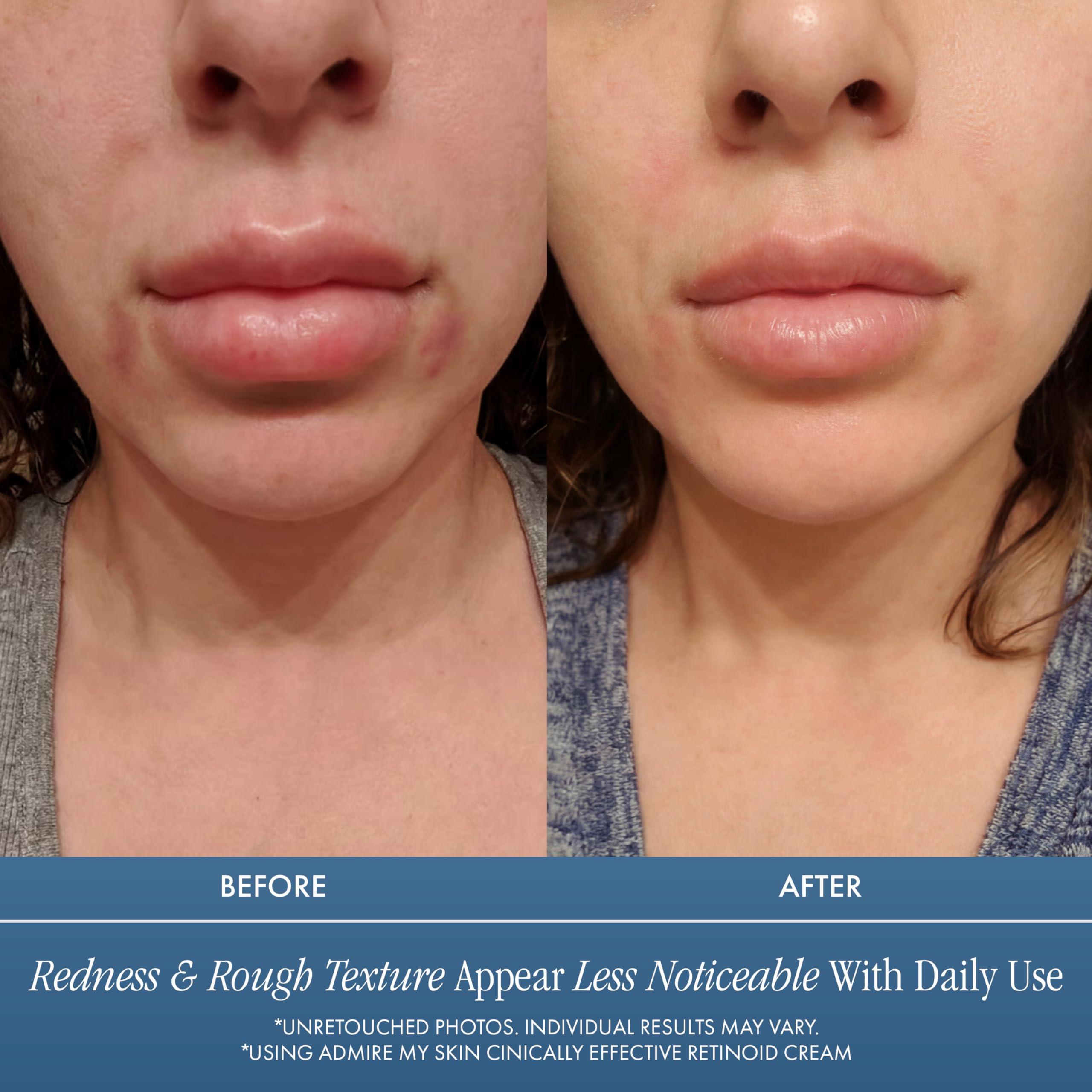 Texture riche de crème rétinoïde offrant hydratation et fermeté perceptible sur la peau.