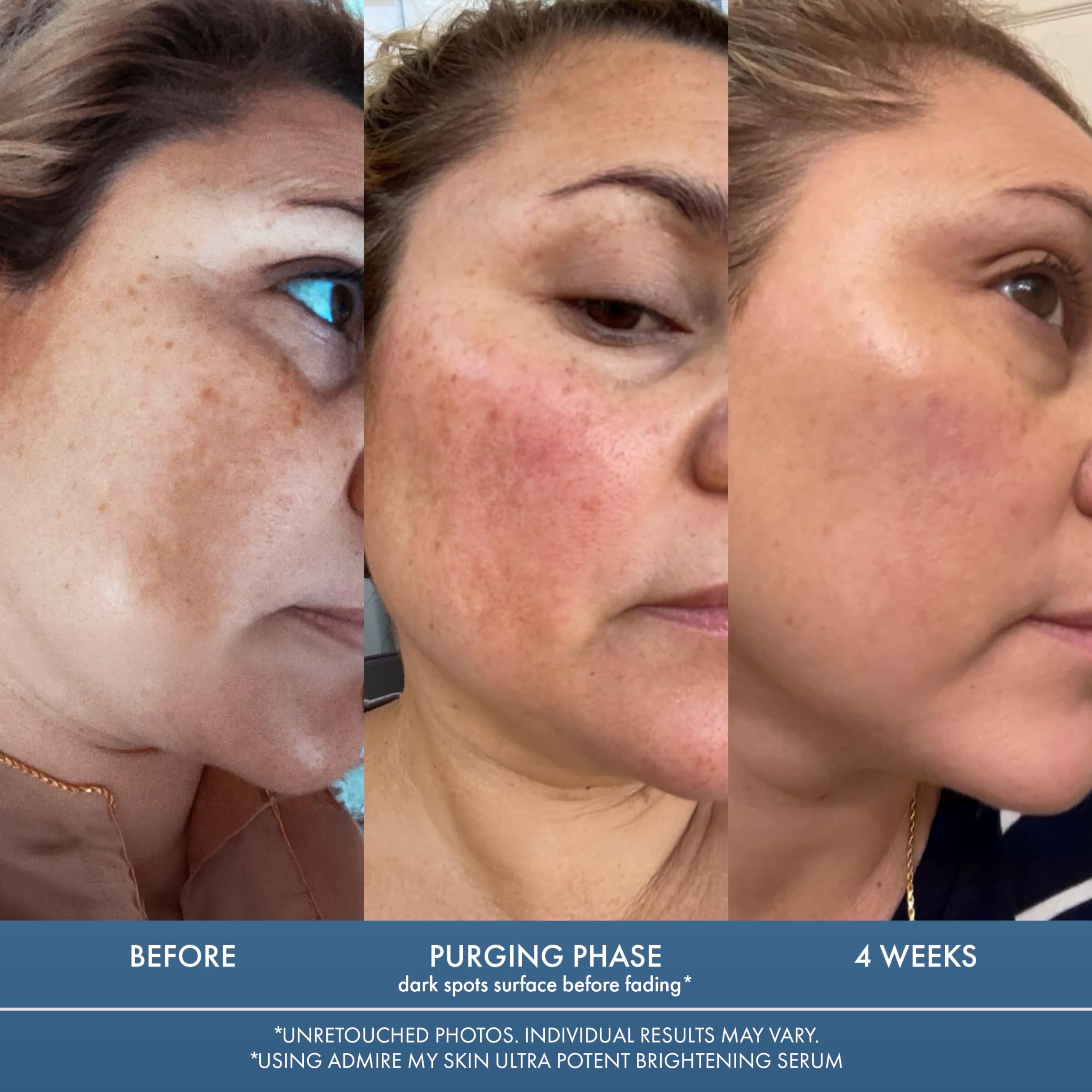 Emballage bouteille 30 ml Admire My Skin, format pratique.