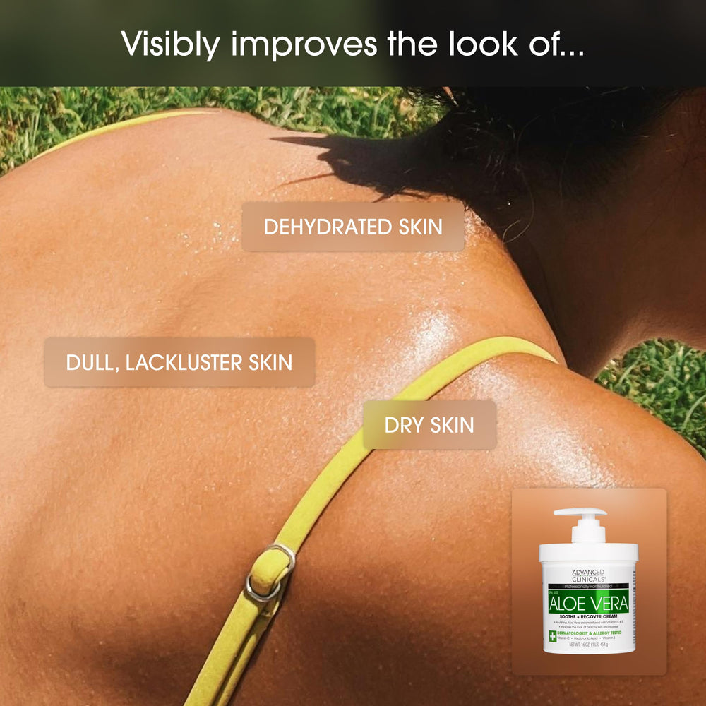 Advanced Clinicals Aloe Vera Lotion, vitamine E: protection émolliente pour la peau.