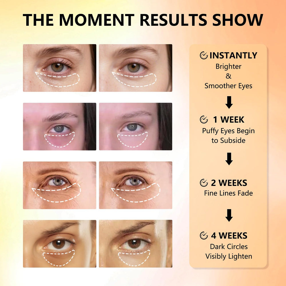 Patchs yeux Aeryea, effet froid rafraîchissant et soin ciblé autour des yeux.