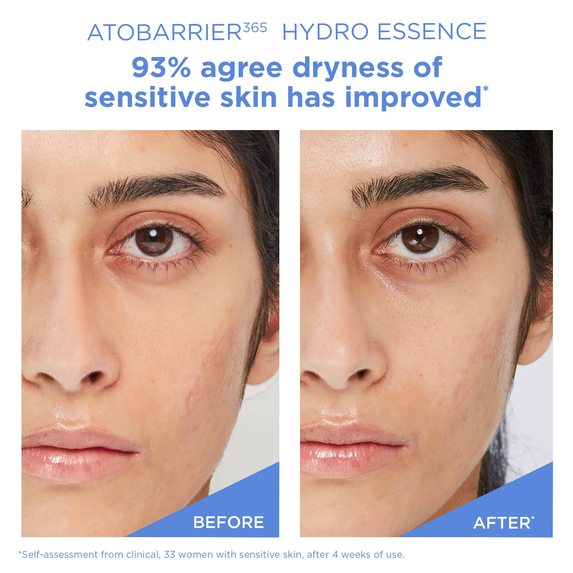 AESTURA ATOBARRIER365 Hydro Essence – utilisation matin et soir pour une routine hydratante.