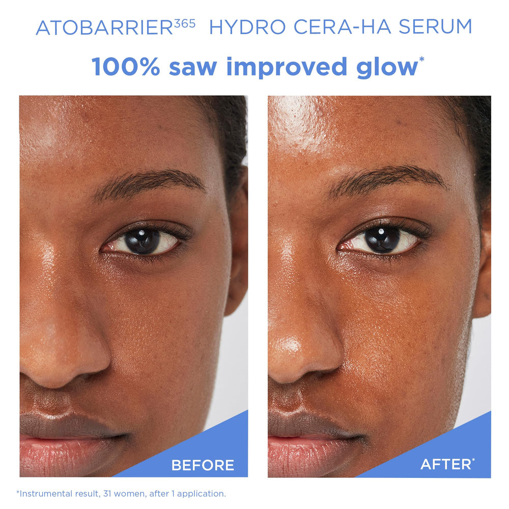 Sérum AESTURA ATOBARRIER365: Niacinamide et vitamine E pour nourrir.
