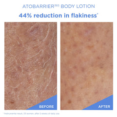 AESTURA ATOBARRIER365, vitamine E et panthenol: hydratation durable pour peaux sensibles.