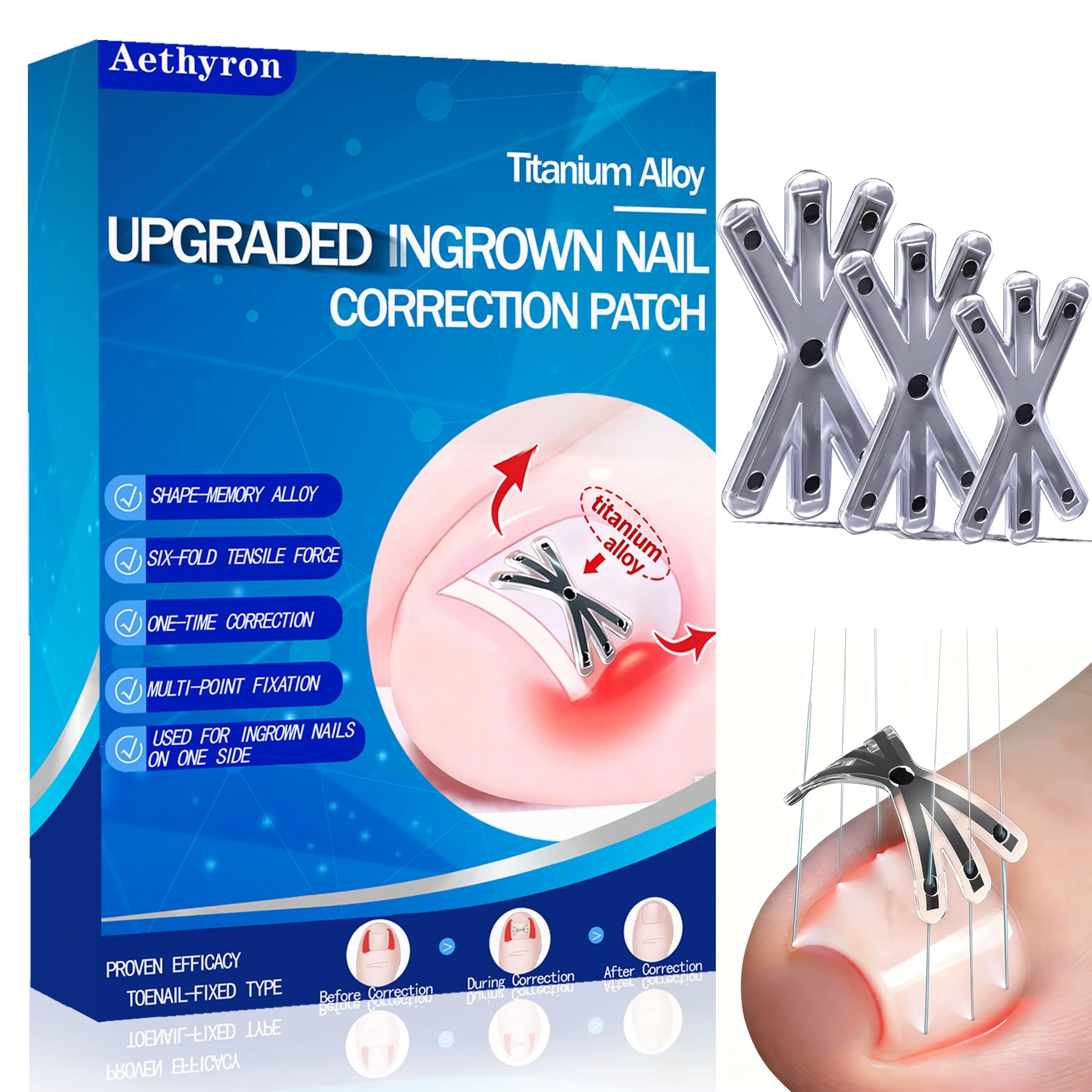 Correcteur Aethyron design étoile 6 angles sur l’ongle pour une correction ciblée