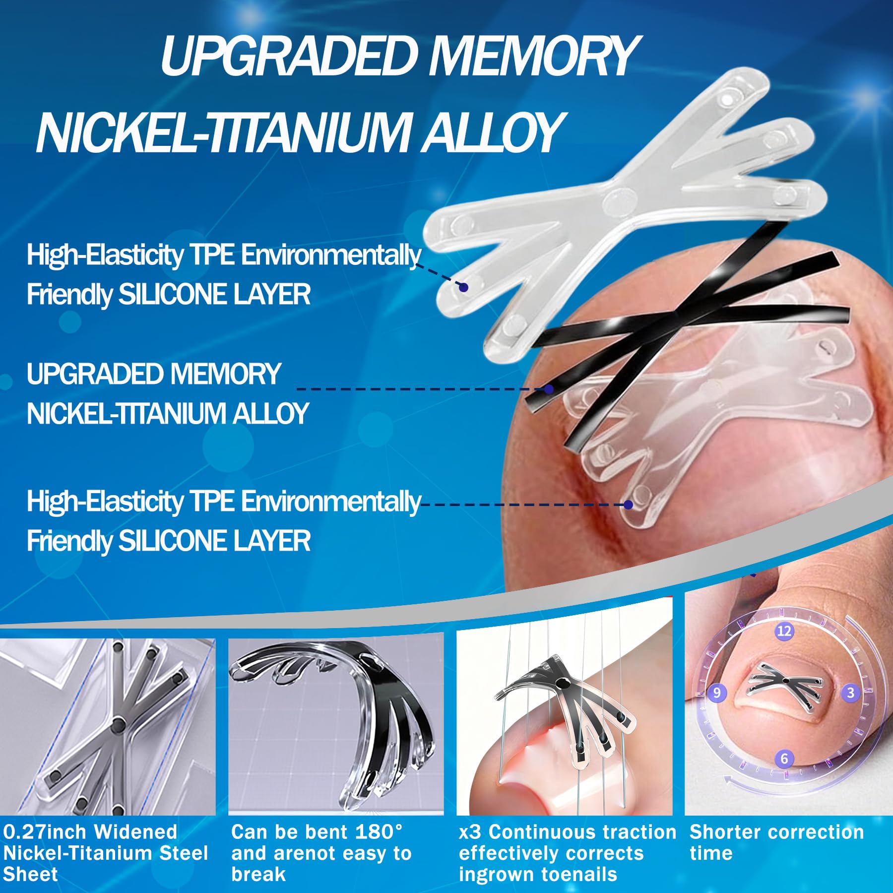 Matériau nitinol à mémoire de forme du correcteur Aethyron