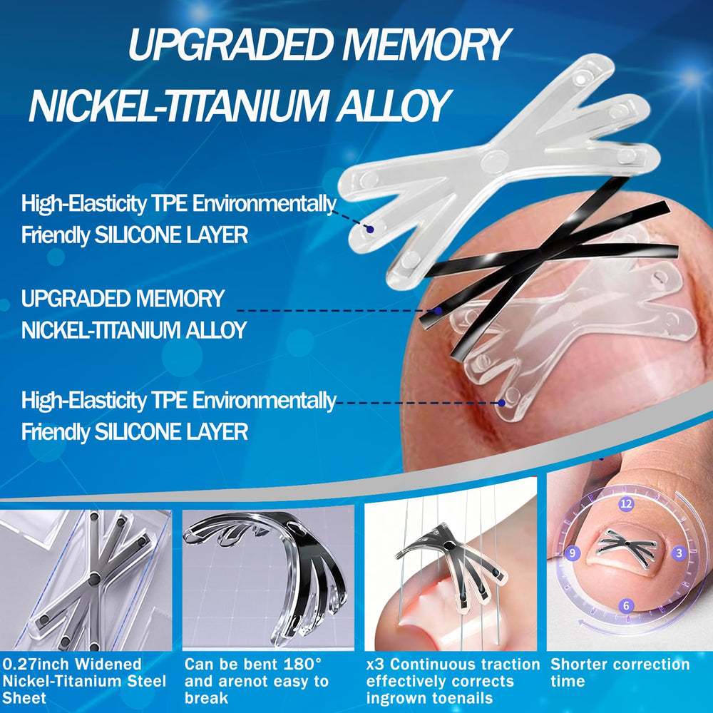 Matériau nitinol à mémoire de forme du correcteur Aethyron