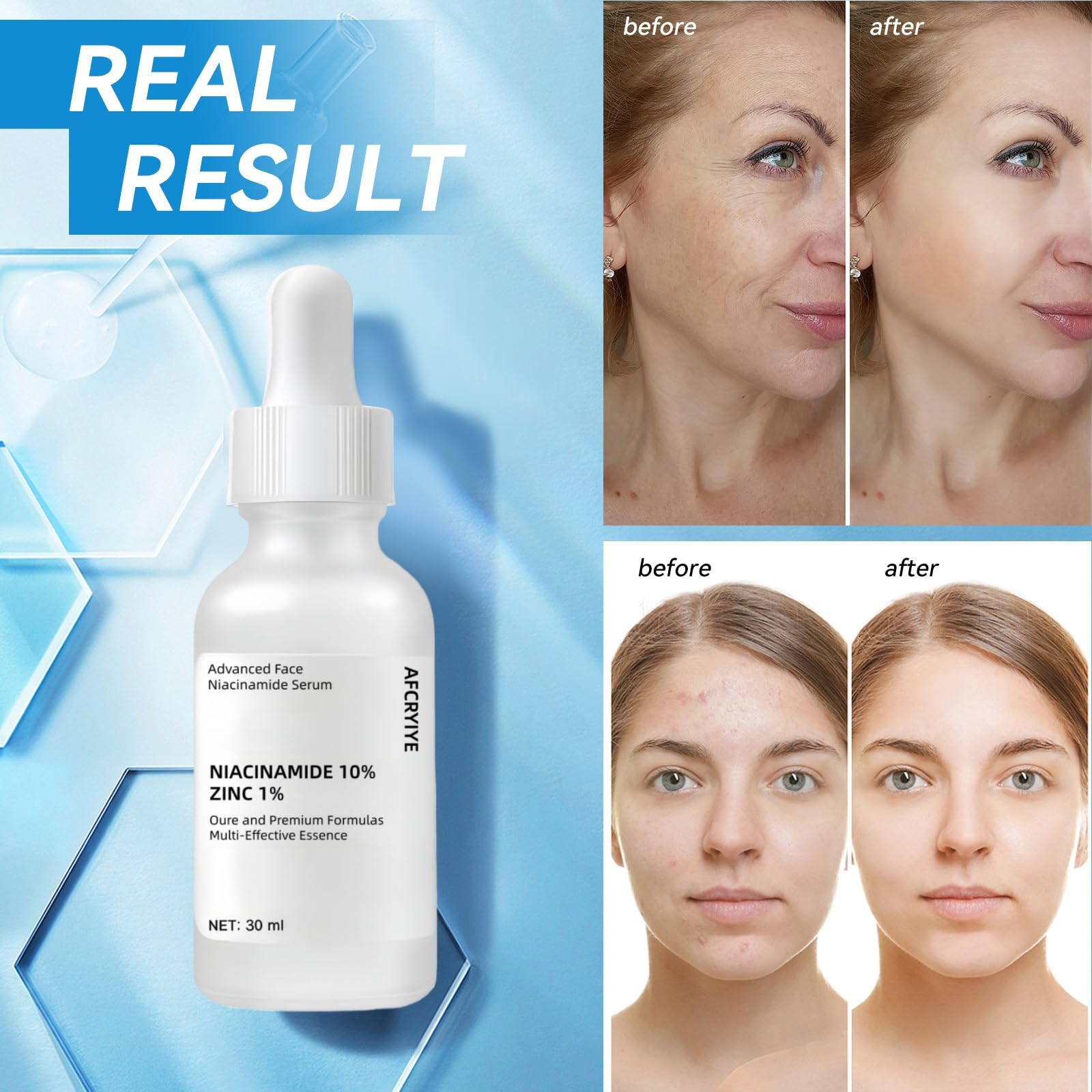 AFCRYIYE Niacinamide 10% + Zinc 1% – présentation minimaliste pour routine beauté sans parfum.