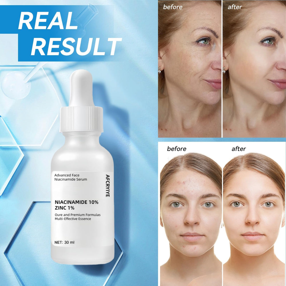 AFCRYIYE Niacinamide 10% + Zinc 1% – présentation minimaliste pour routine beauté sans parfum.