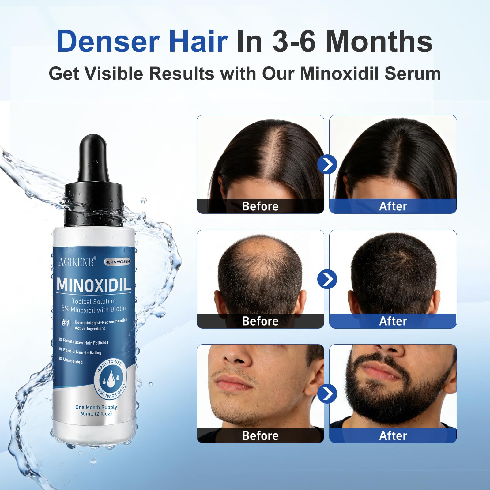 AGIKENB soin barbe minoxidil – Stimule la croissance des poils et définit les contours.