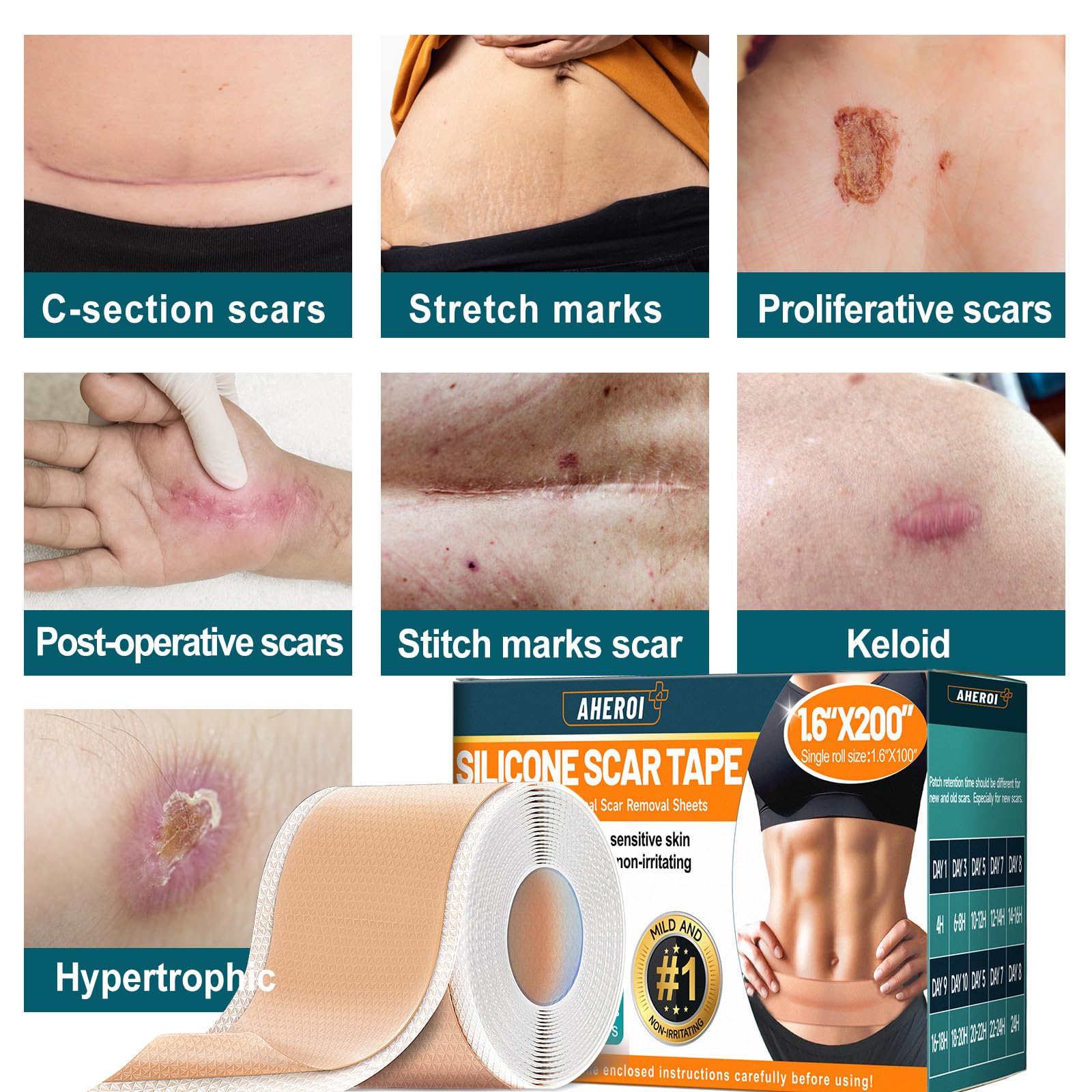 Hygiène et adhérence – bandes silicone Aheroi, double emballage sûr.