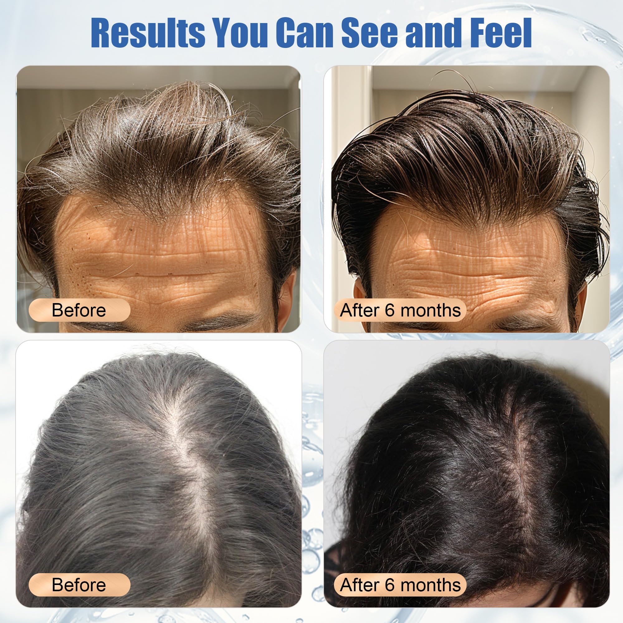 AivtaPurePro Yuaben Minoxidil 5% application mousse sur cuir chevelu