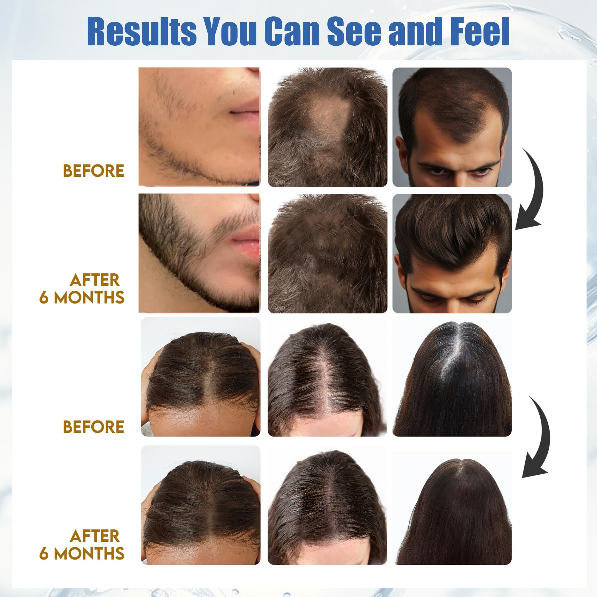 AivtaPurePro Yuaben Minoxidil 5% bouchon doseur pratique