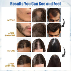 AivtaPurePro Yuaben Minoxidil 5% bouchon doseur pratique