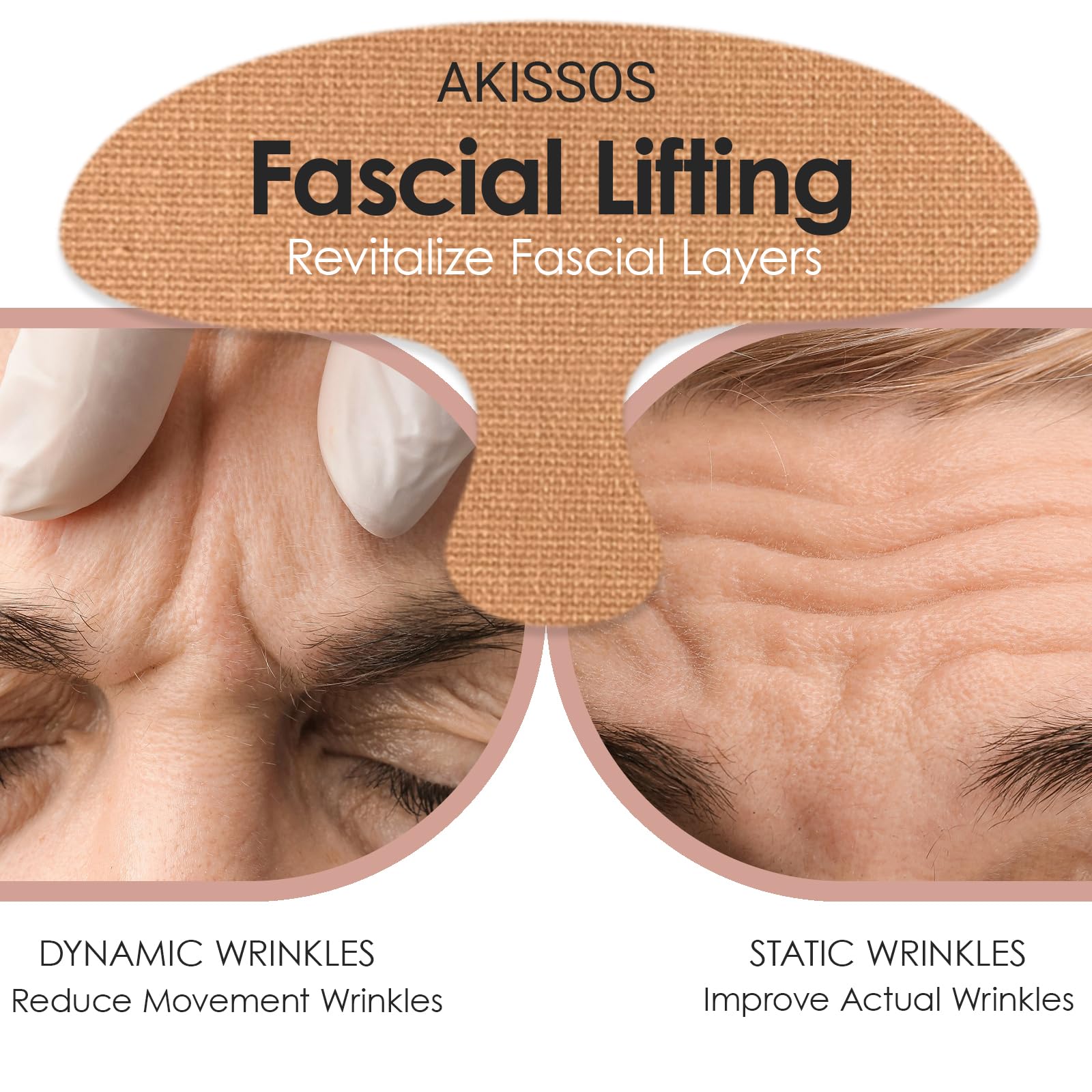 Patch Akissos front 11 lignes, ciblage des rides fines pour un aspect lisse