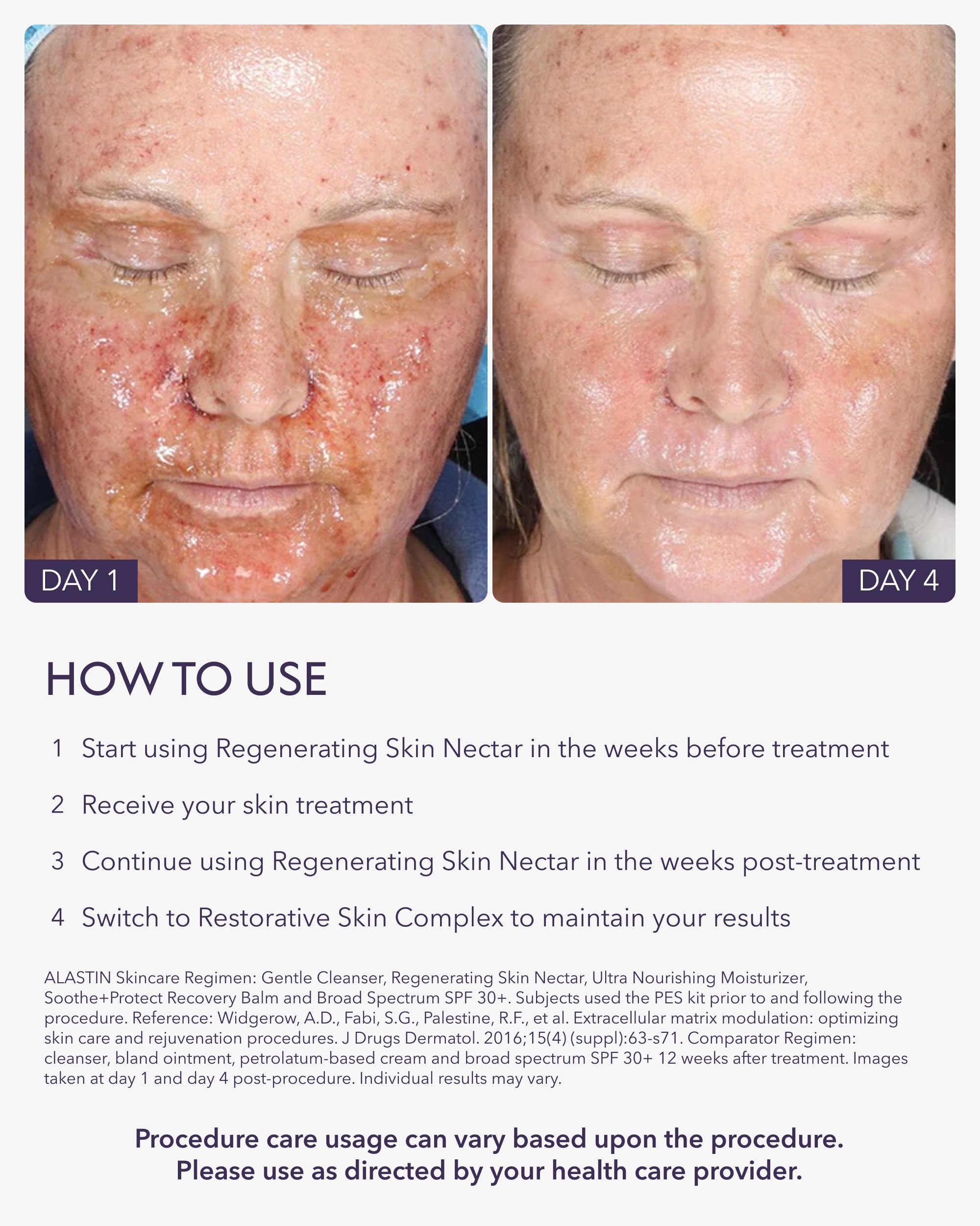 Application visage d'ALASTIN Regenerating Skin Nectar après procédure, apaisement et confort.