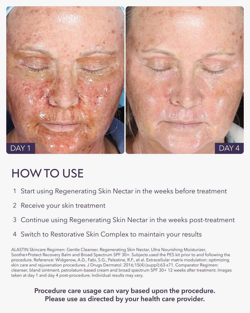 Application visage d'ALASTIN Regenerating Skin Nectar après procédure, apaisement et confort.
