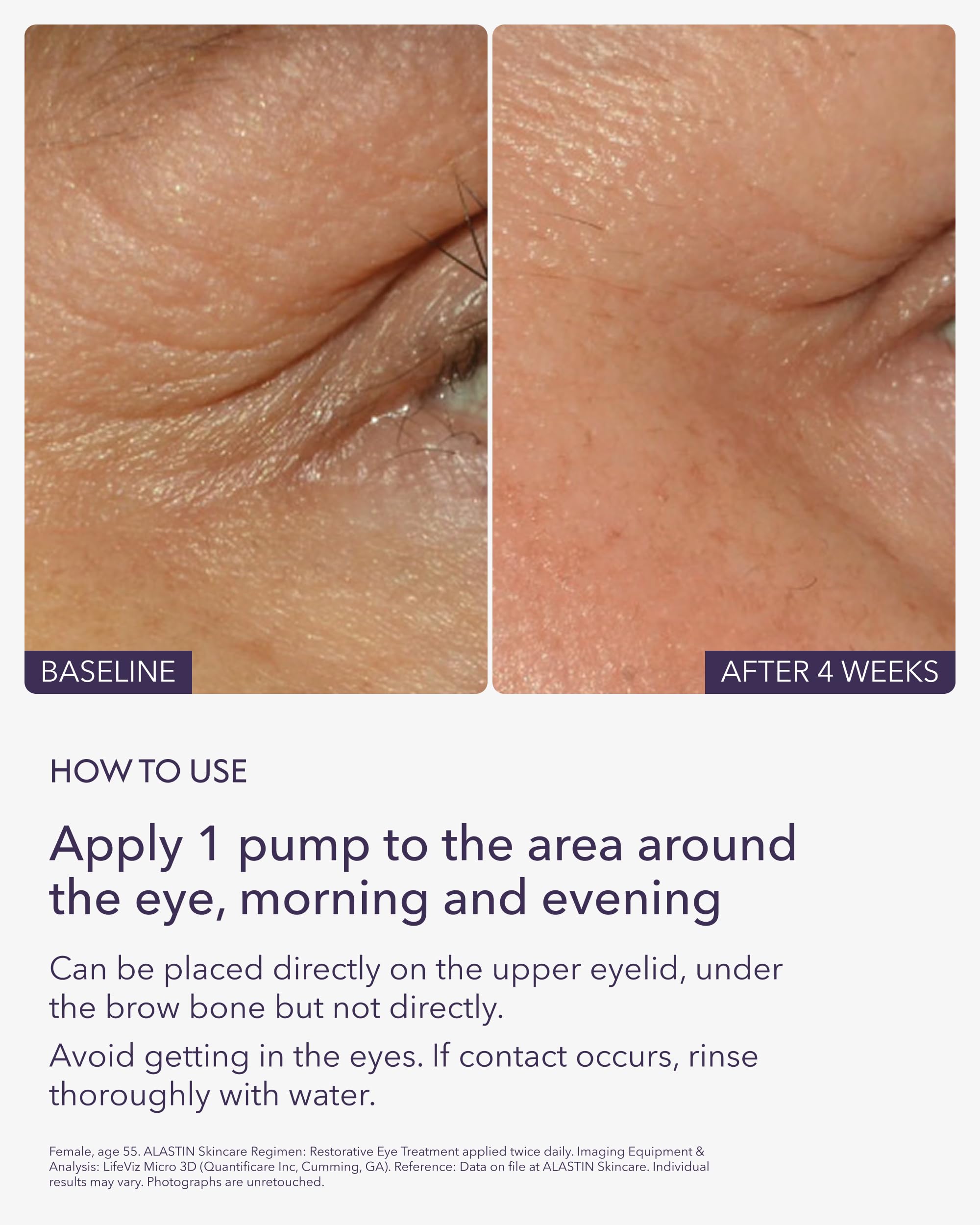 Crème hydratante ALASTIN pour le contour des yeux.