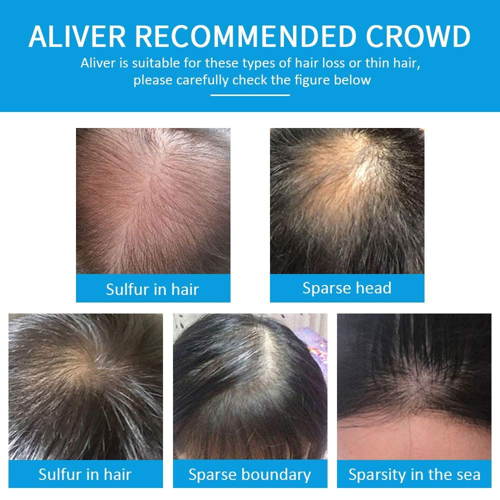 ALIVER Hair Fibers suitable for men and women