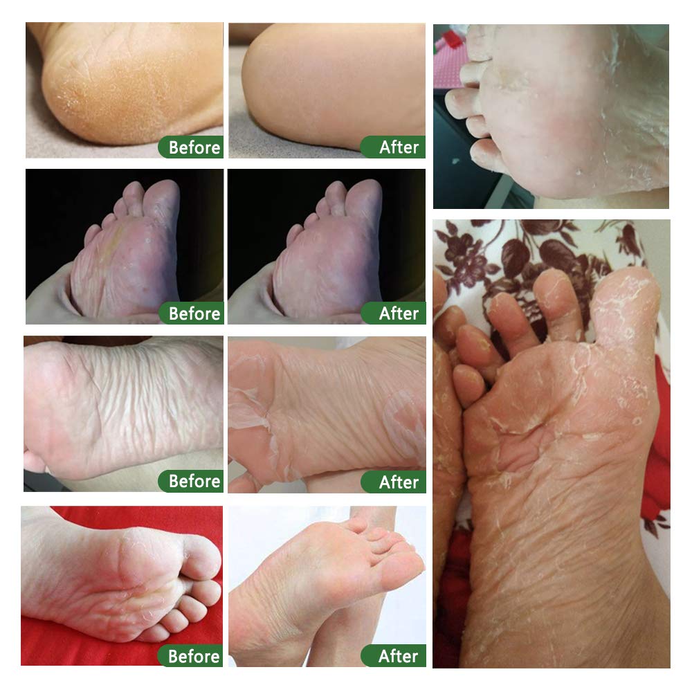 ALIVER masque-pieds-aromatherapie: senteurs apaisantes lavande.
