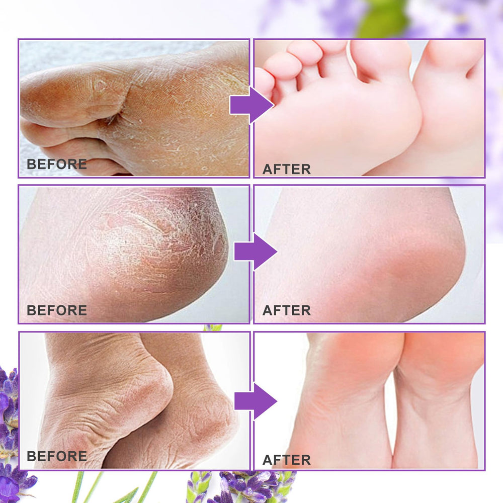 ALIVER texture masque exfoliant pieds lavande, résultat velouté après utilisation.