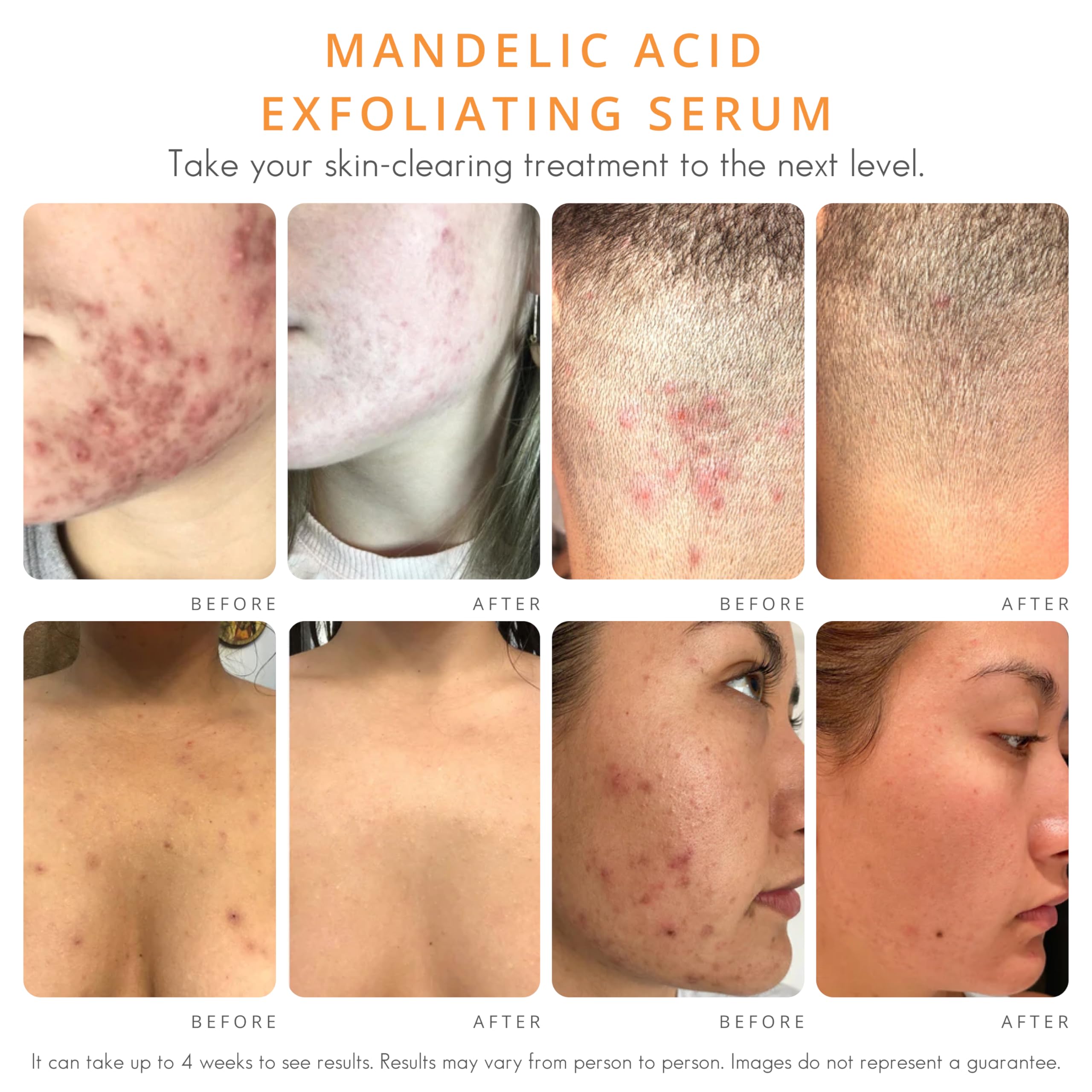 Texture liquide crème du Sérum Almond Clear pénètre rapidement.