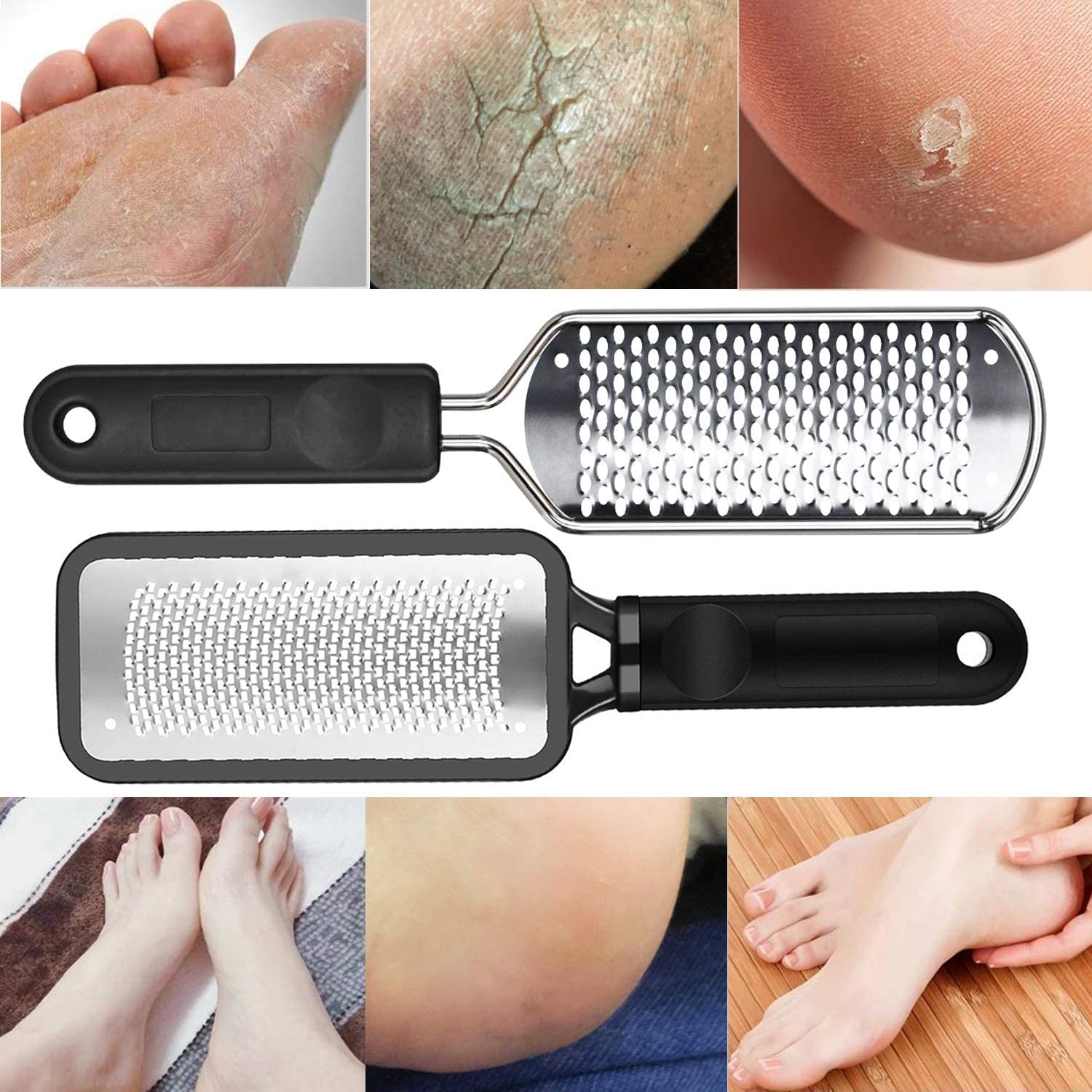 ALOCKMA raspe pédicure, usage quotidien pour pieds doux.
