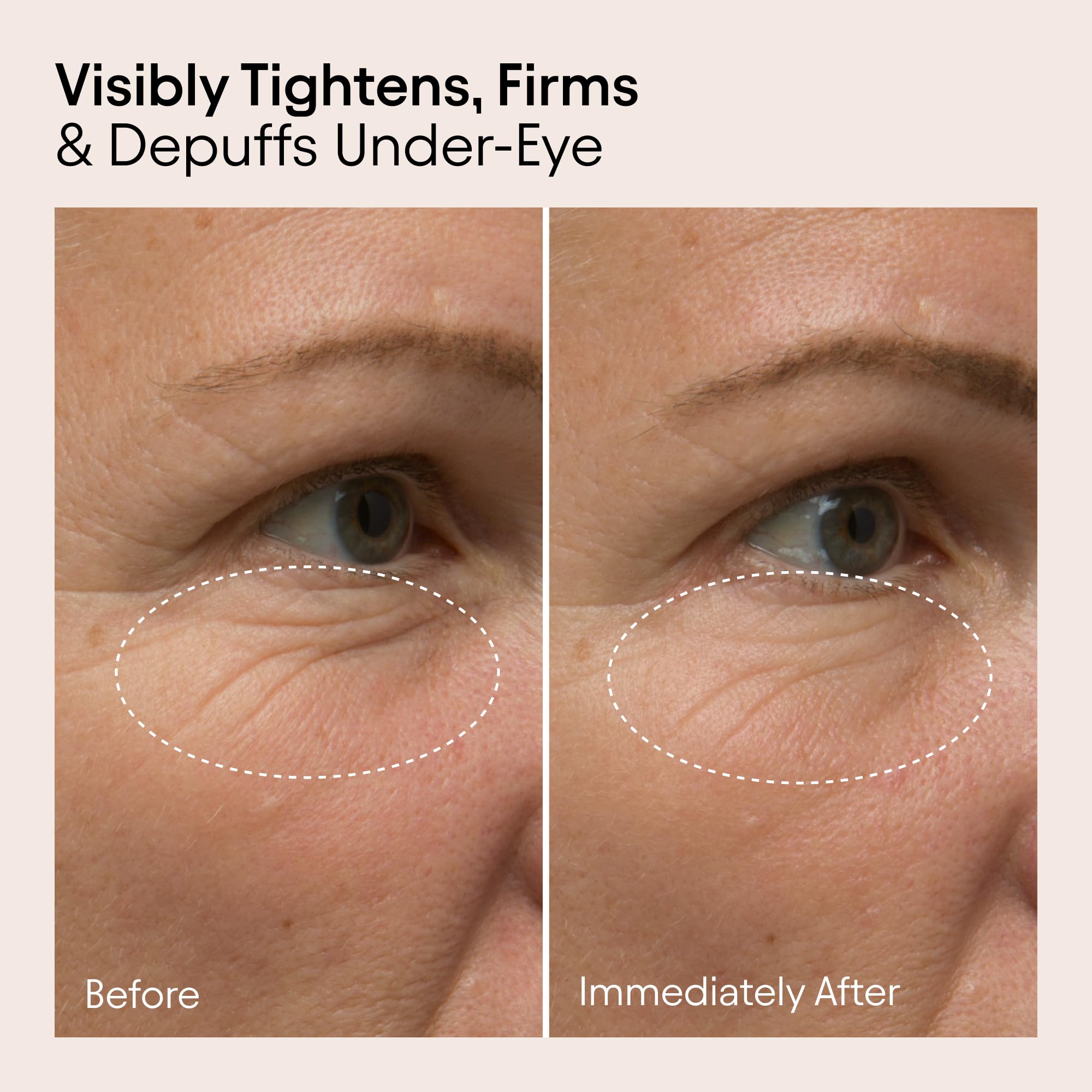 Ridules autour des yeux lissées avec une texture légère.