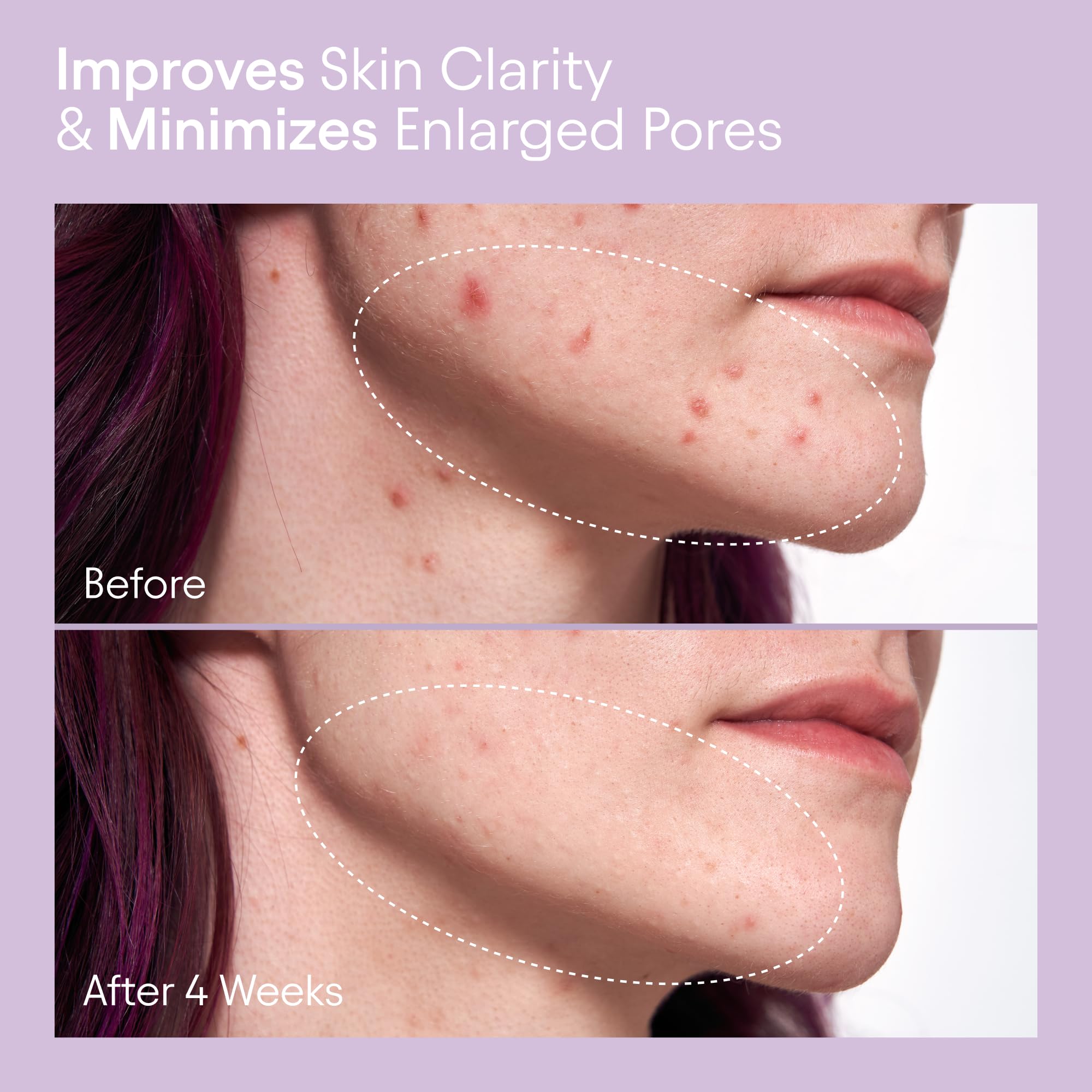 Alpyn Beauty tonique tremella: texture hydratante et légère sur peau