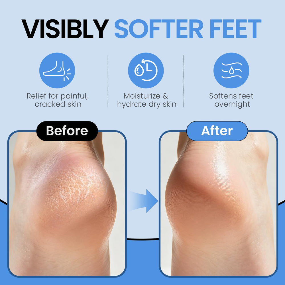 ALUROICE détail silicone doux, texture agréable pour la peau des pieds.