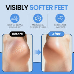 ALUROICE détail silicone doux, texture agréable pour la peau des pieds.