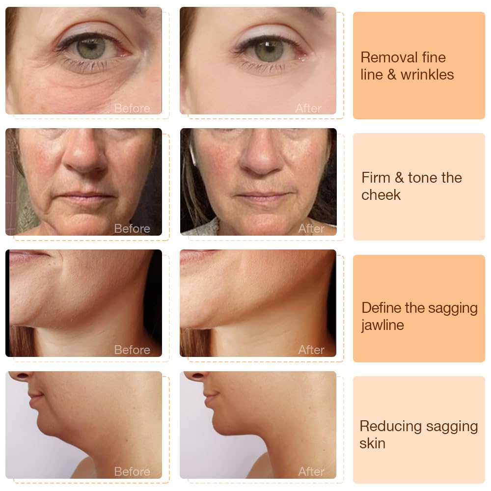 ALUSHEE Nulift: massage facial stimulant la microcirculation.