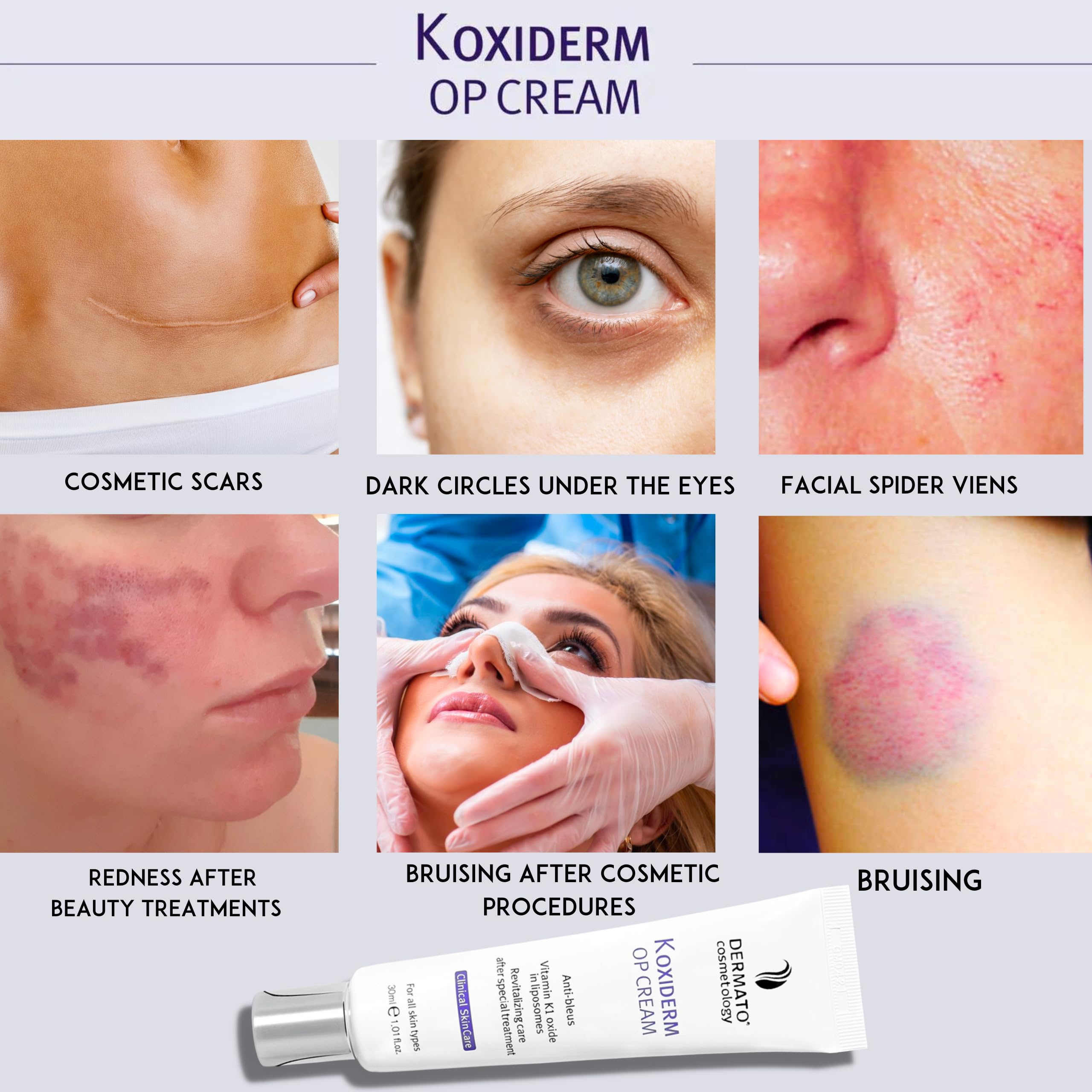 Anacis Crème Oxiderm réduit les cernes et poches autour des yeux pour un regard plus frais