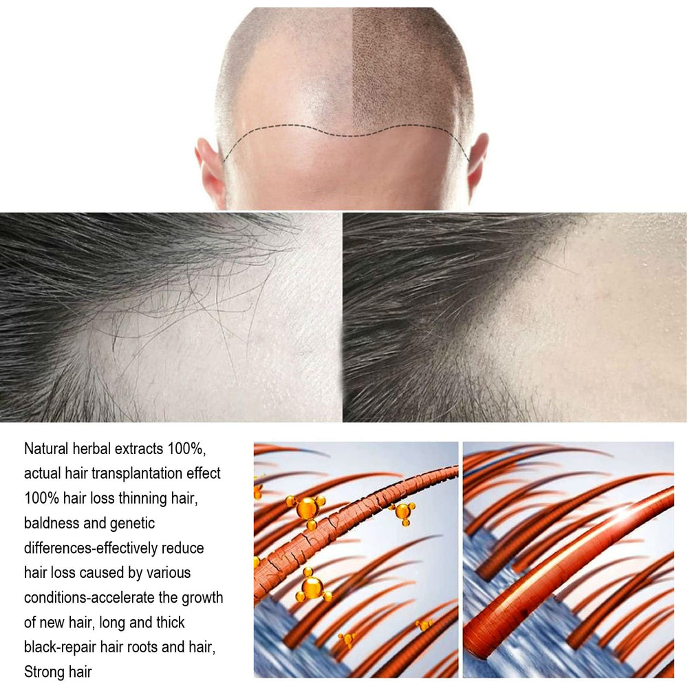 ANEFOSE cheveux-plus-denses: aspect visuel plus épais et soigné