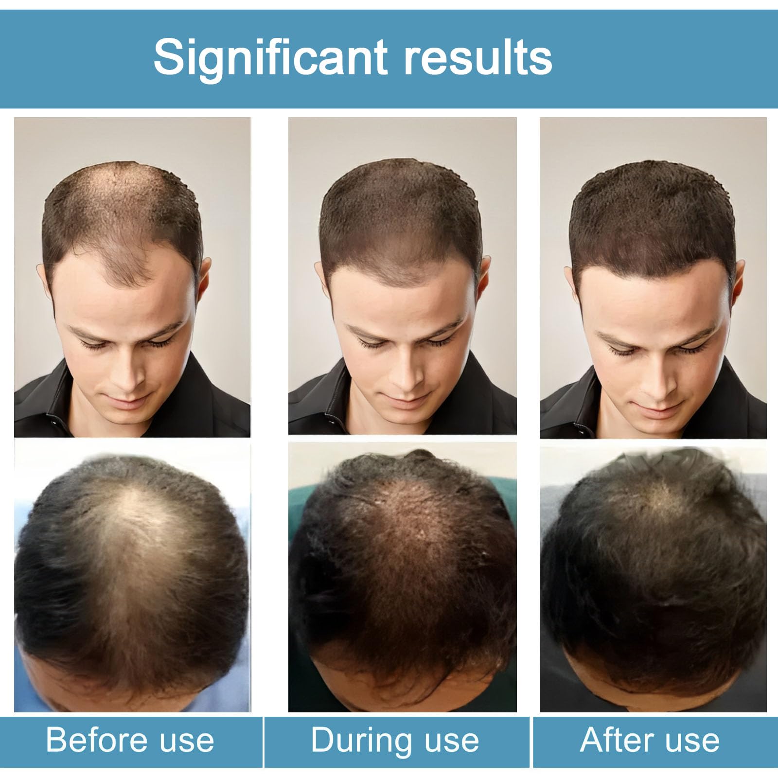 ANEFOSE kératine nourrissante: cheveux plus forts et résistants