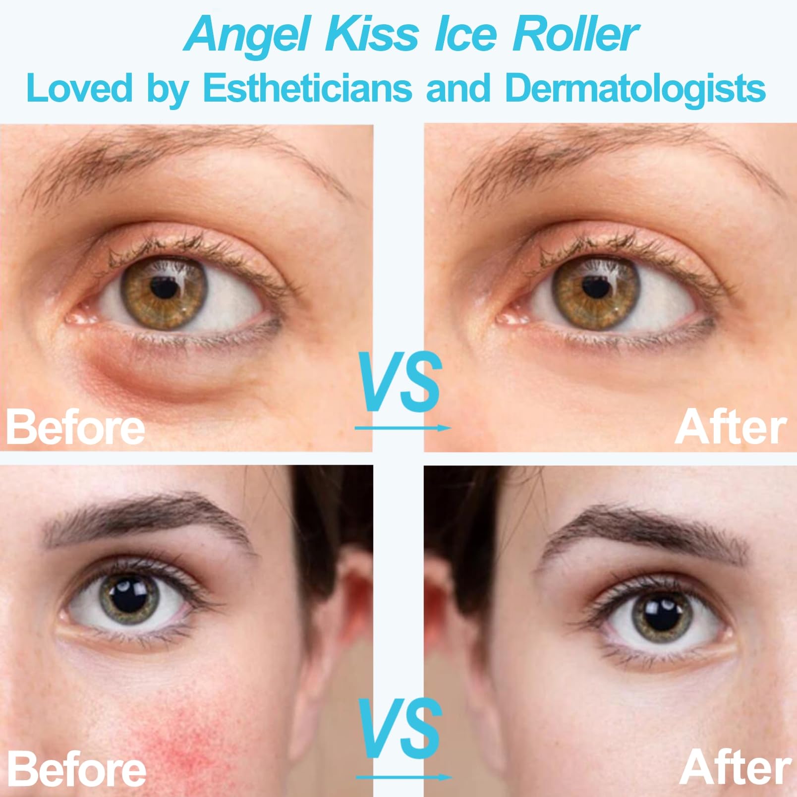 Angel Kiss Ice Roller apaisement après soleil apaise et rafraîchit la peau