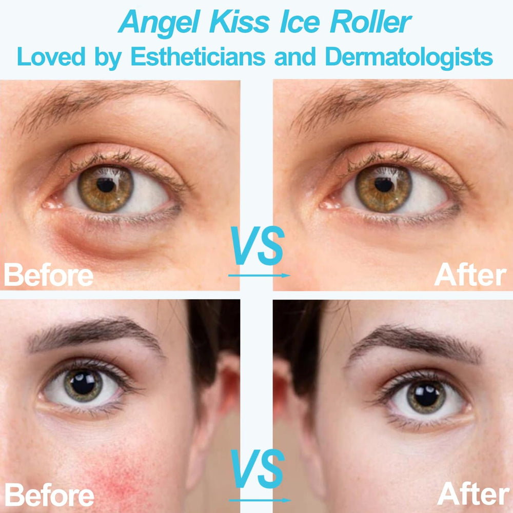 Angel Kiss Ice Roller apaisement après soleil apaise et rafraîchit la peau