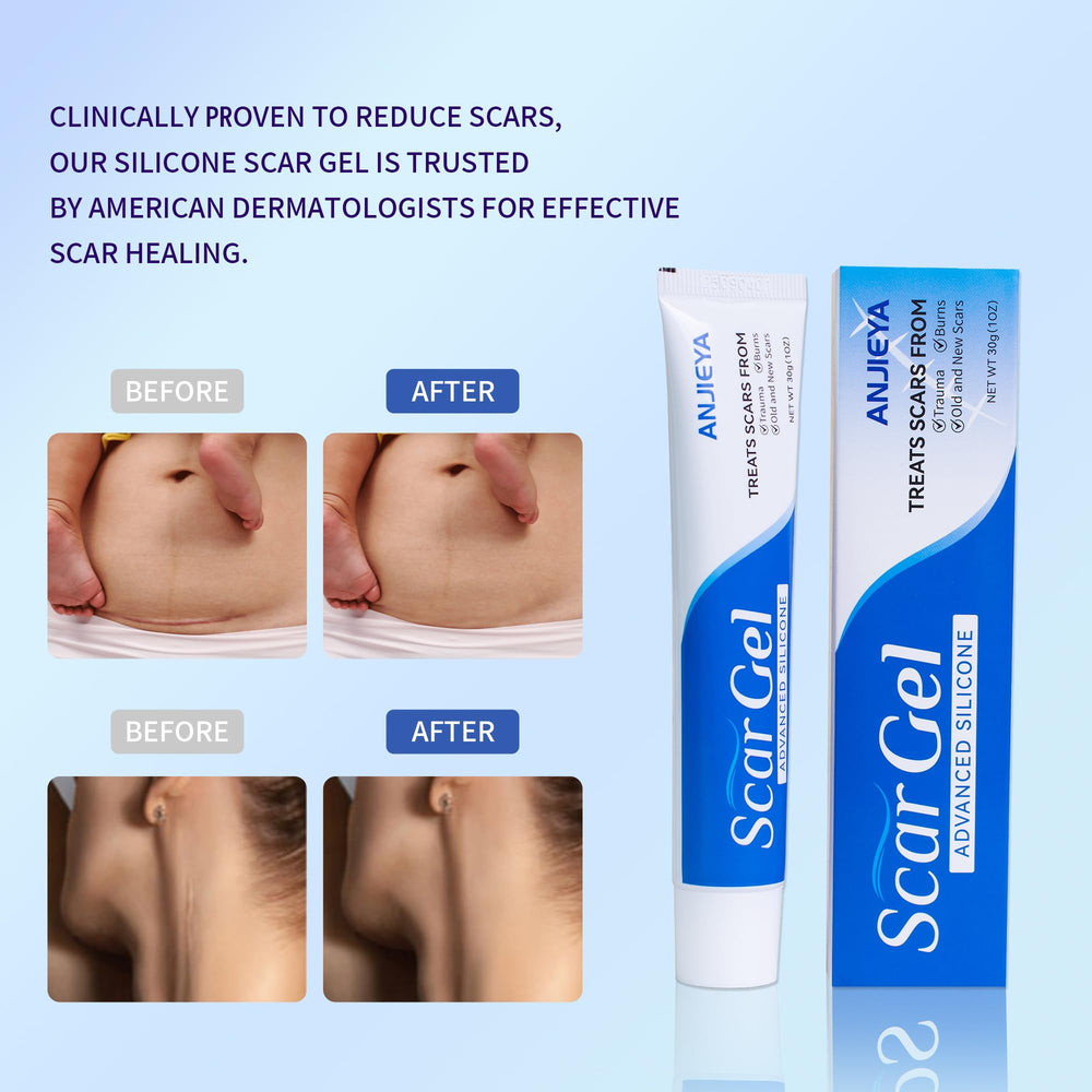 ANJIEYA Gel Silicone – visage et cicatrices, utilisation sur diverses zones